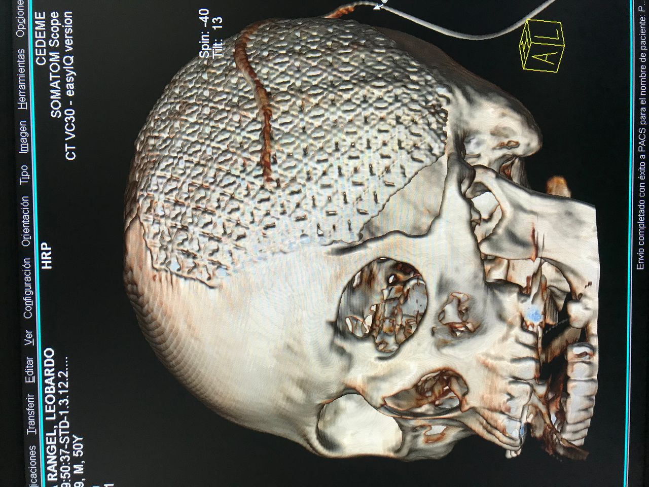 Rafael Maciel Morfin-4