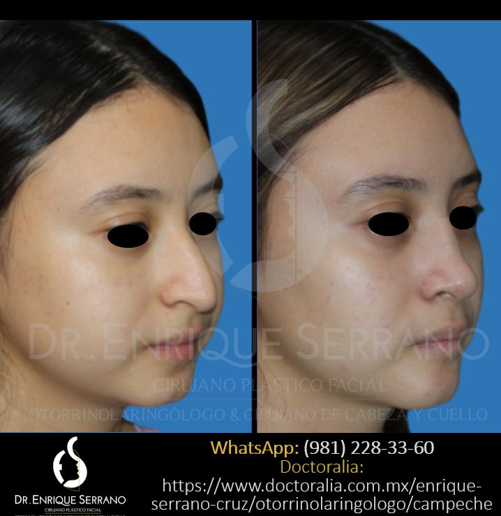 Enrique Serrano Cruz-51