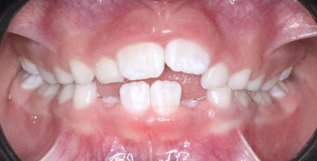 Pedro Badial Aceves-6