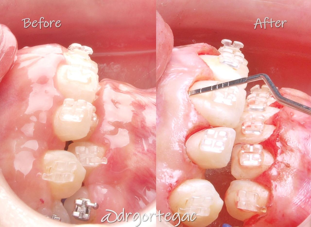 Gonzalo Ortega Carrillo-4