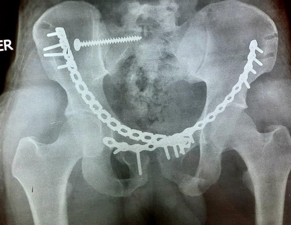 Iván Campos Hernández-2