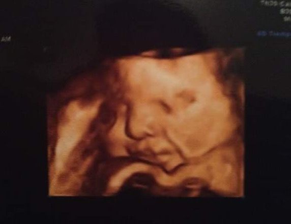 Issumi A. Meza Meneses-2