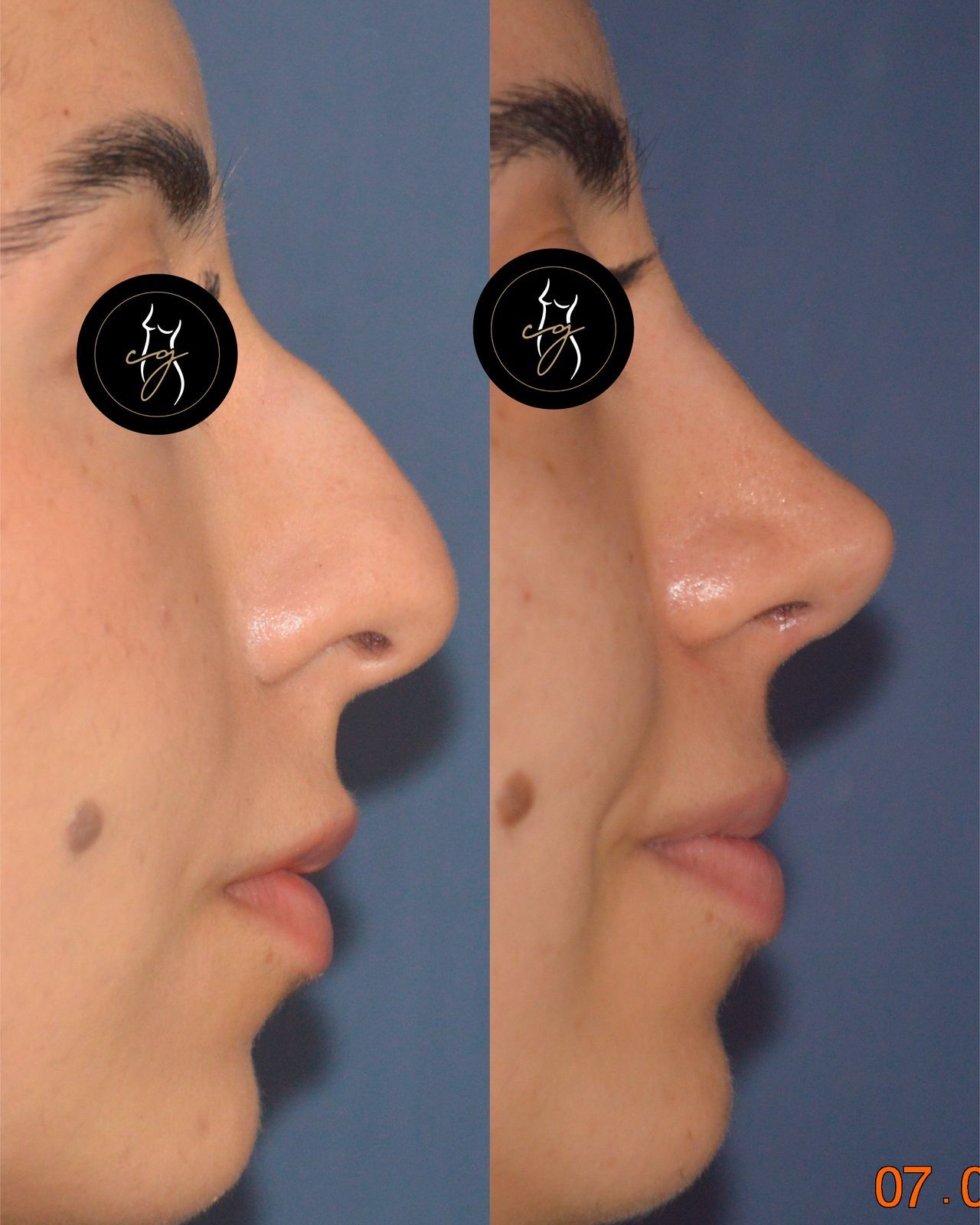 Carlos Alberto Gaitán García-0