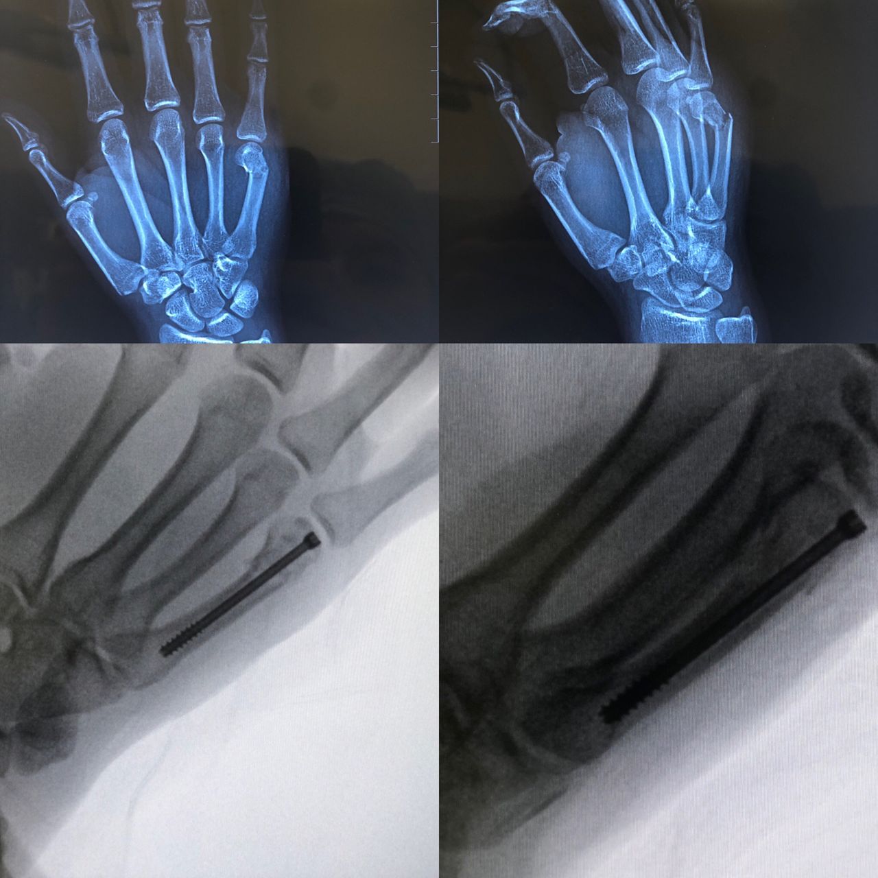 Carlos Ruben Baca Dominguez-1