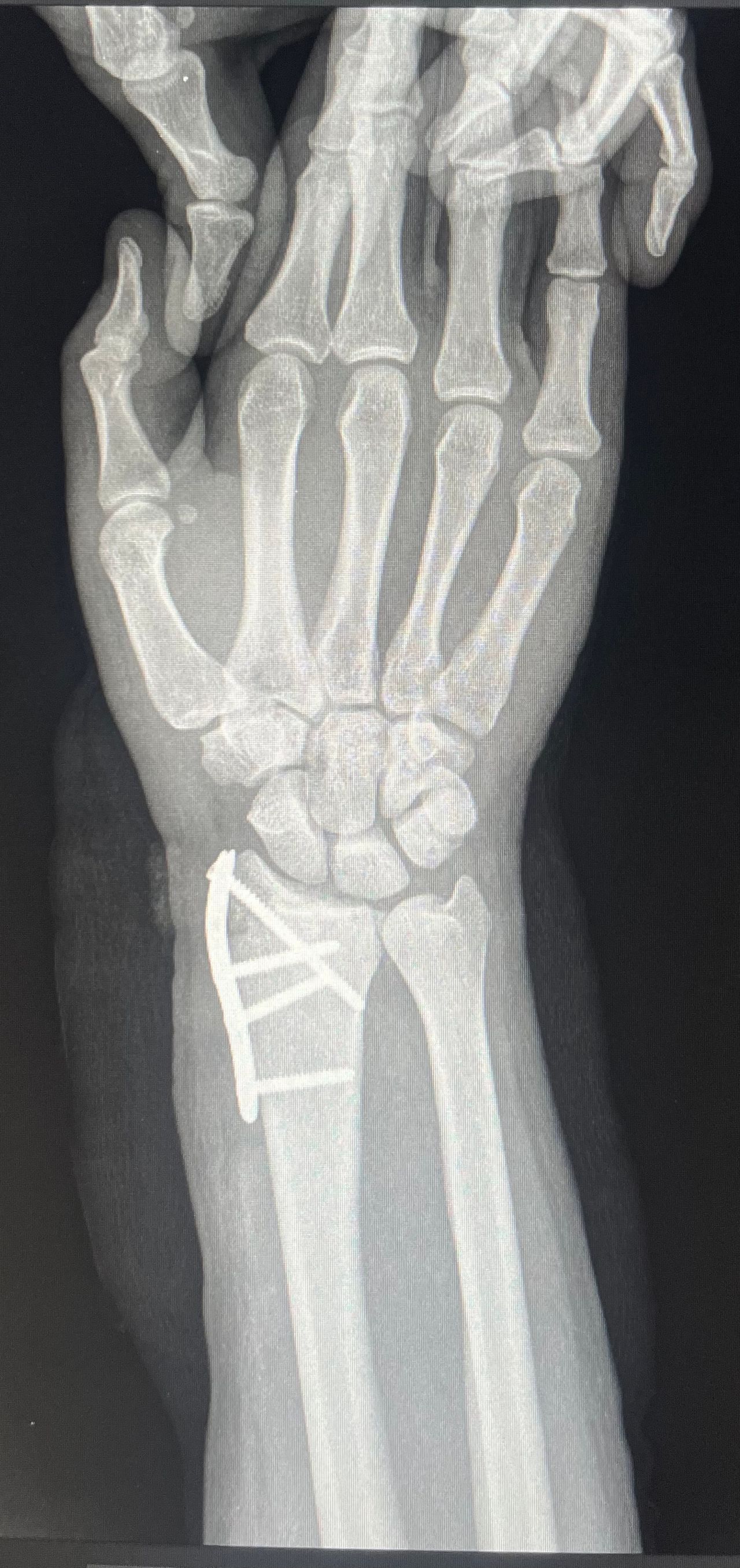 Cristian Ernesto Murillo Medina-1