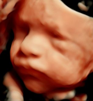 Eduardo Noé Nava Guerrero-4