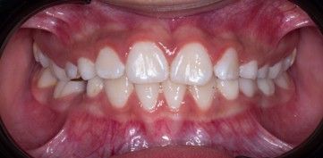 Vicente Emmanuel Silva Rangel-6