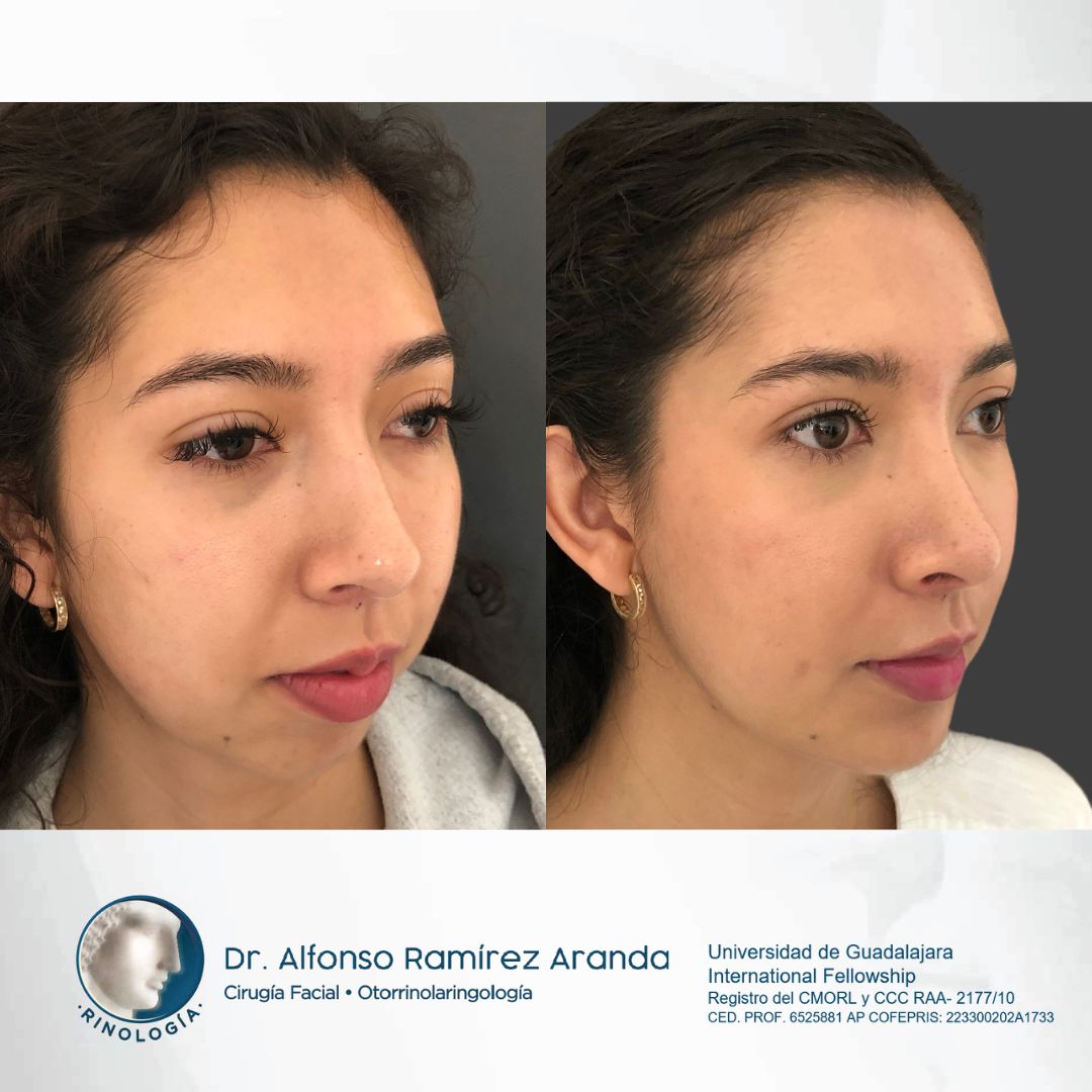 Alfonso Ramírez Aranda-15