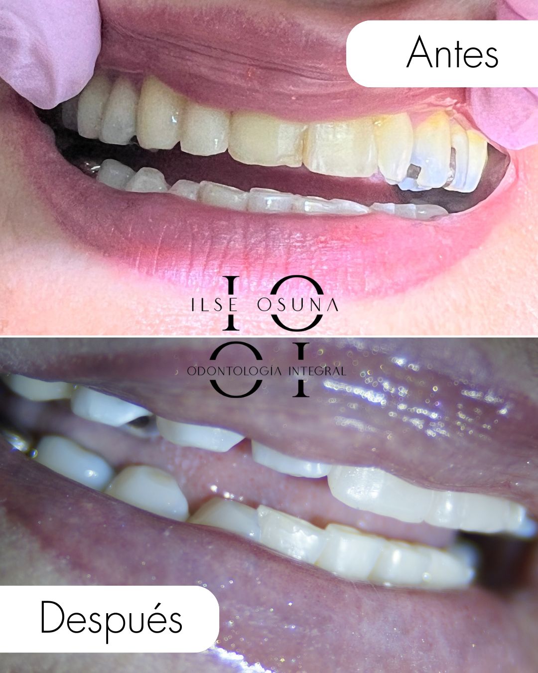 Ilse Valeria Osuna Rodríguez-8