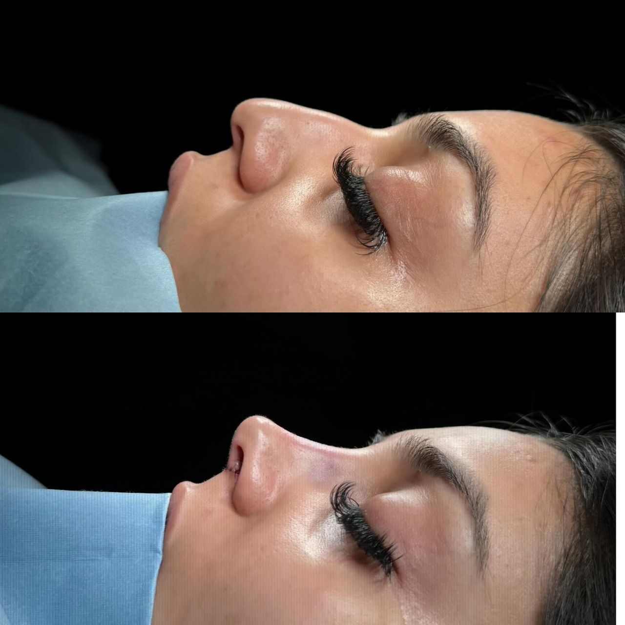 Angel Castro Urquizo-155