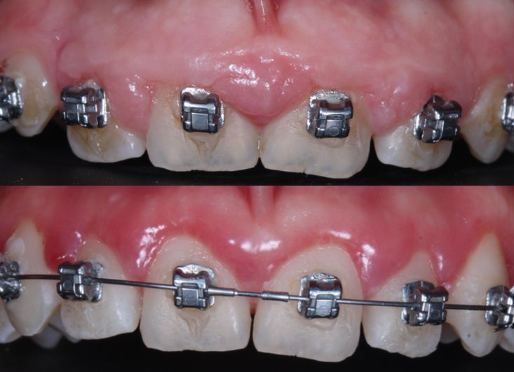 Ireri Rojas Bermúdez-20