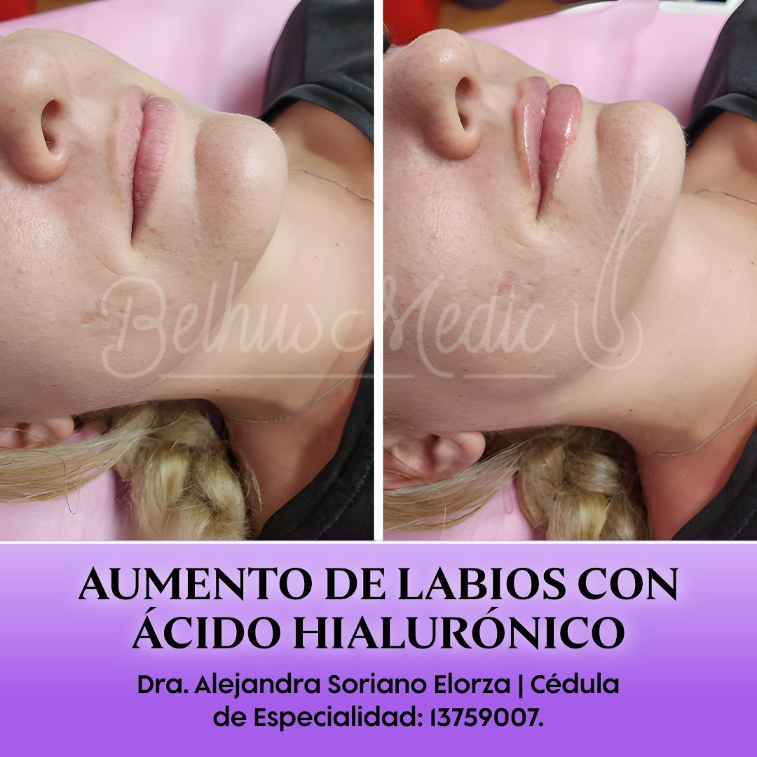 Alejandra Soriano Elorza-71