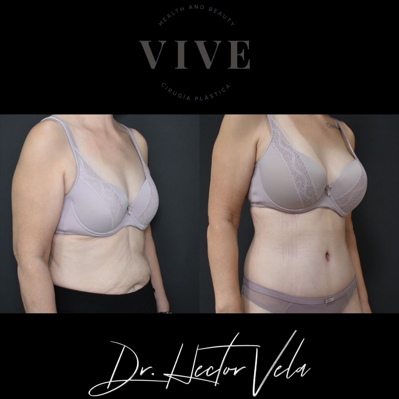 Héctor Eduardo Vela Cardona-74