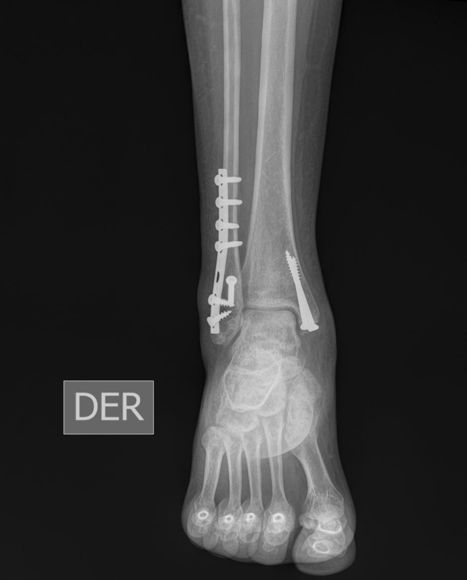 Braulio Roberto Ferreira Dávalos-7