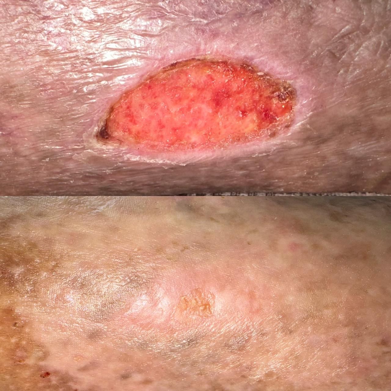 Jhonatan López González-21