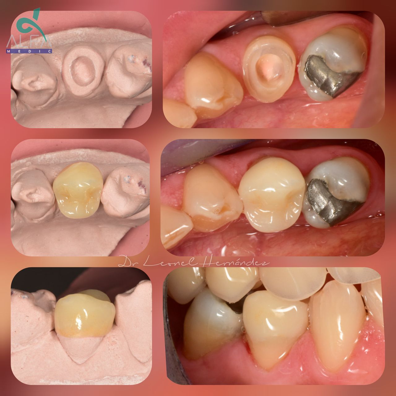 Leonel Hernández Gómez-22