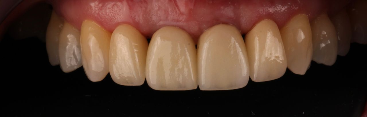 Lilly Bentriz Sifuentes-10