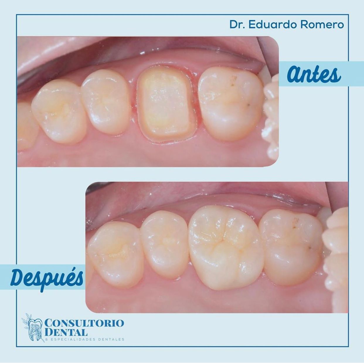 Eduardo Romero López-12