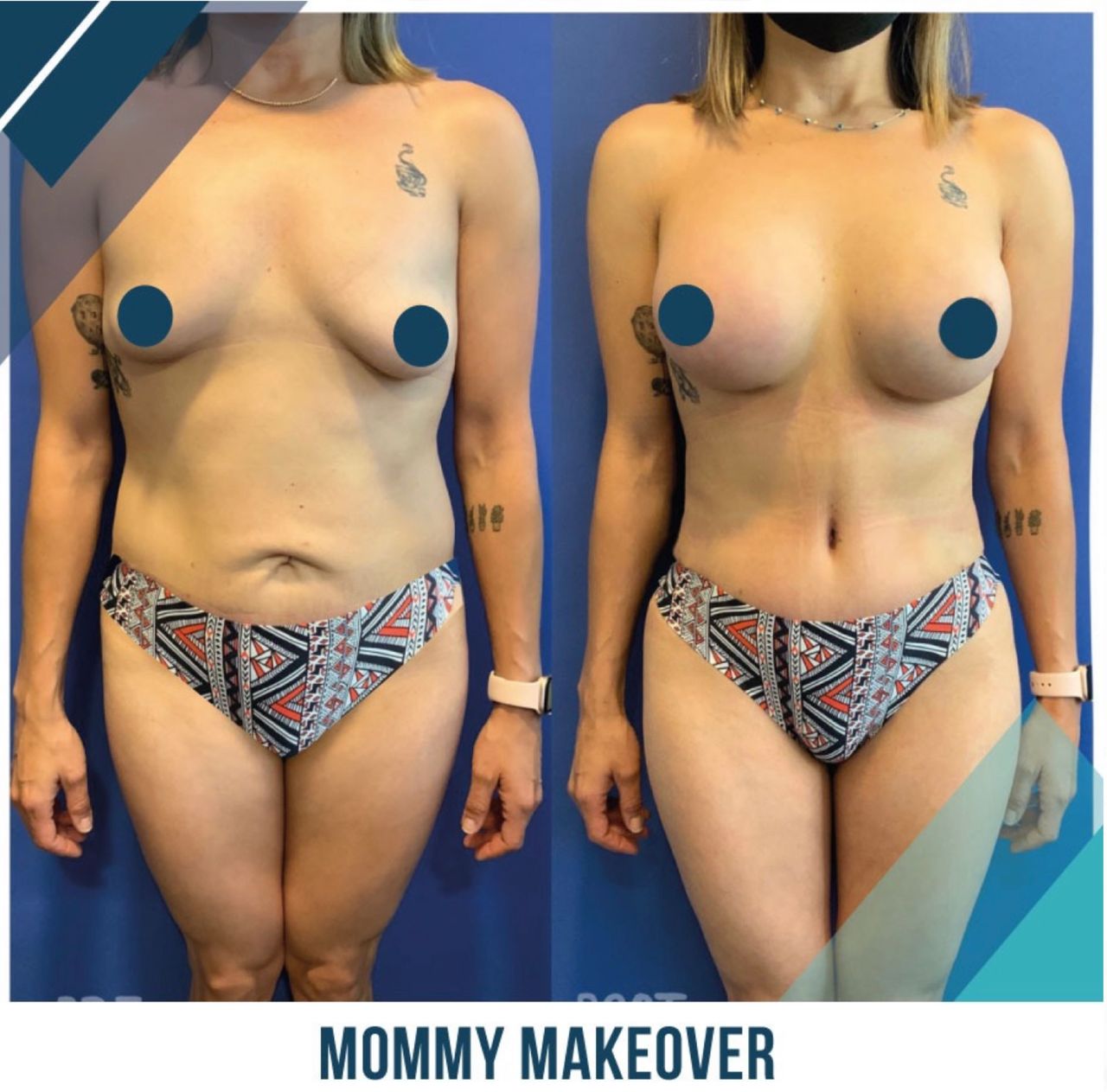 Giuseppe Tanzillo-18