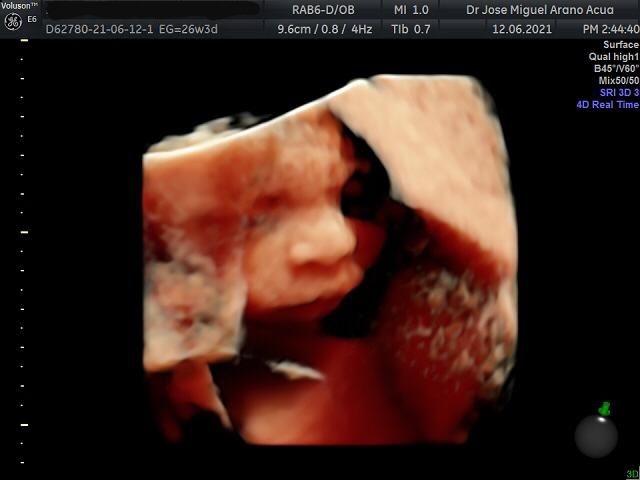 José Miguel Arano Acua-17