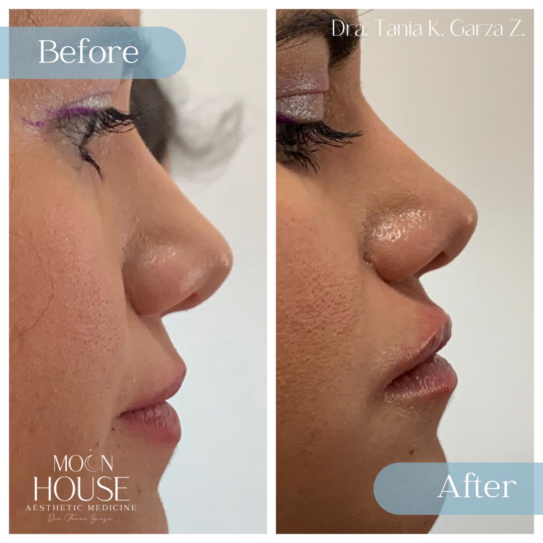 Tania Karine Garza Zepeda-22