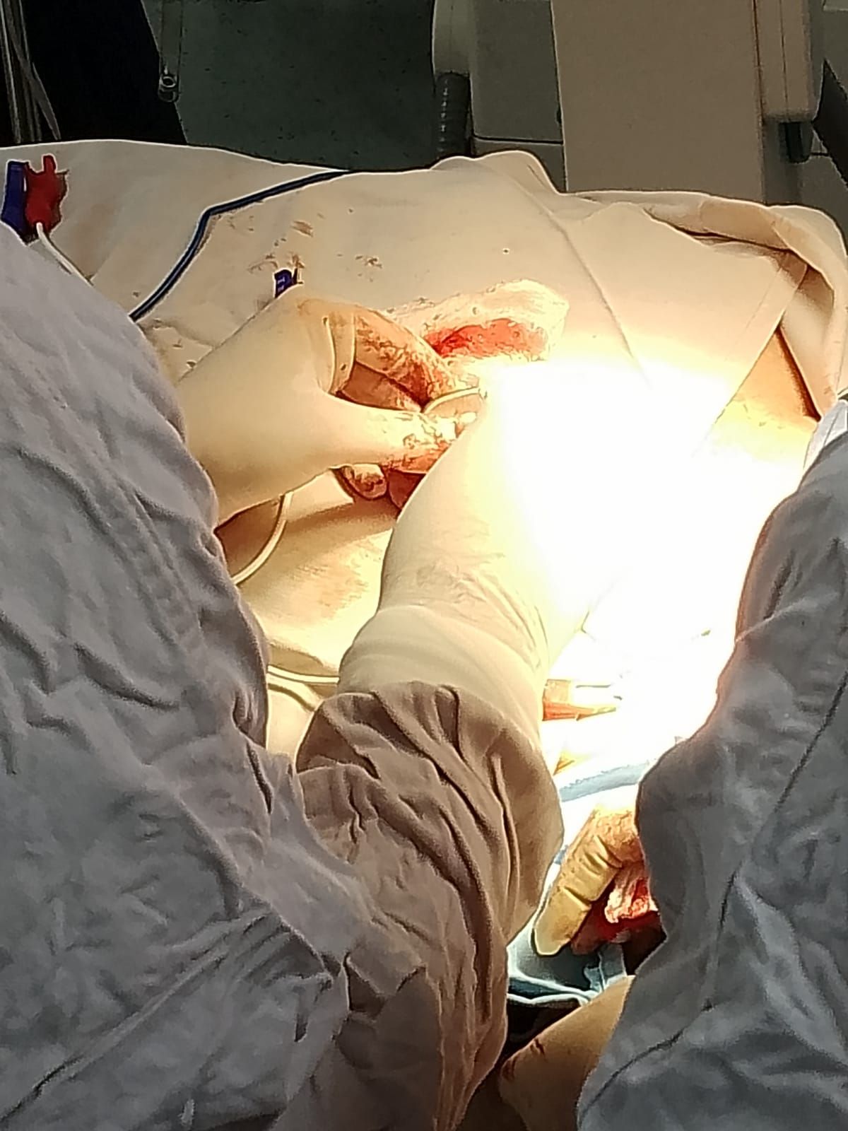 Yanier Coll Muñoz-3