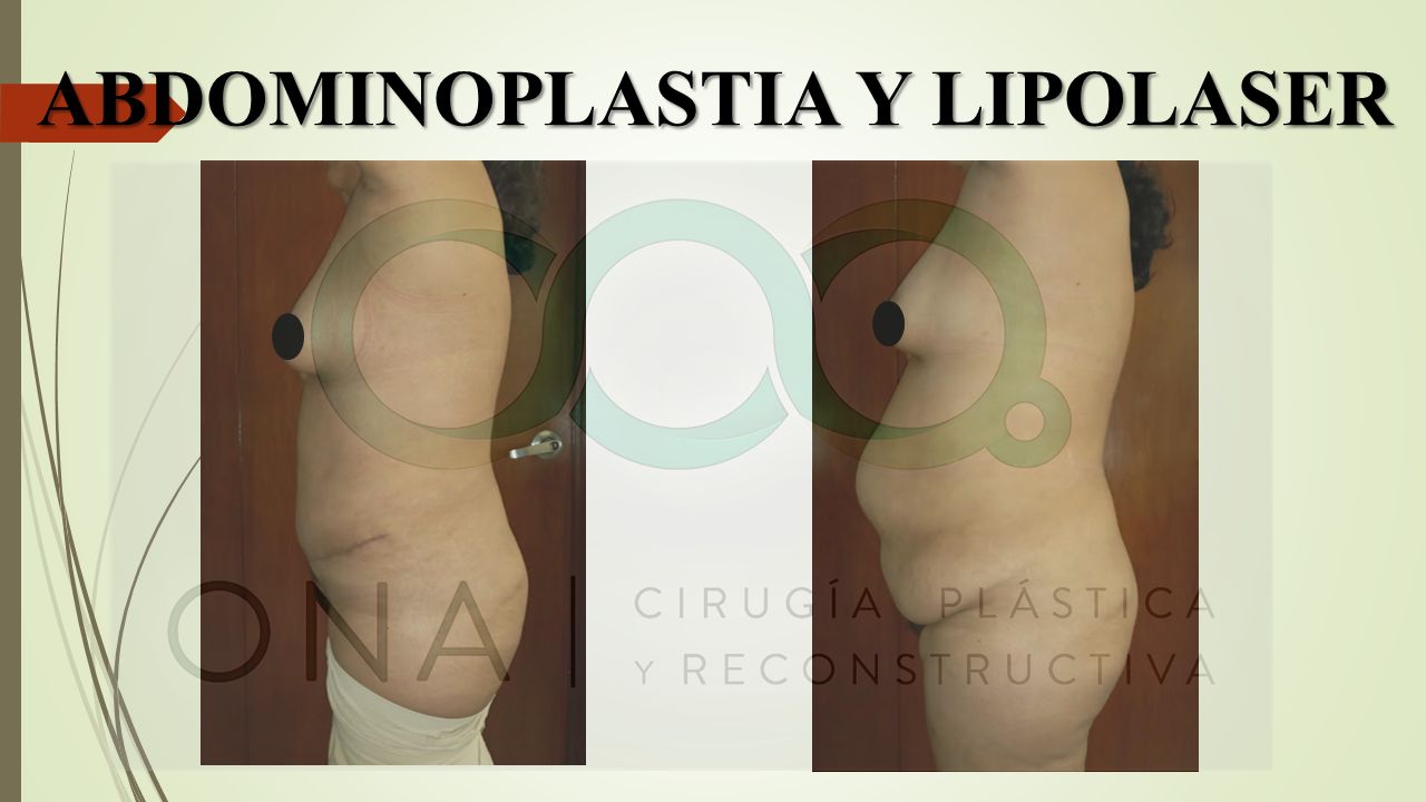 José Luis Segura Castillo-7