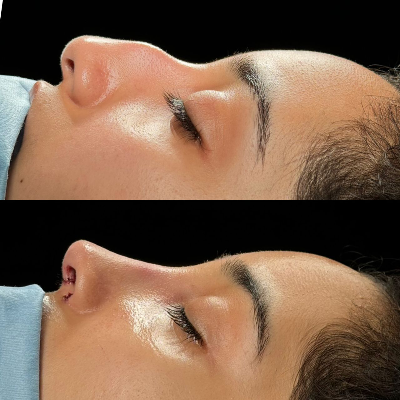 Angel Castro Urquizo-24