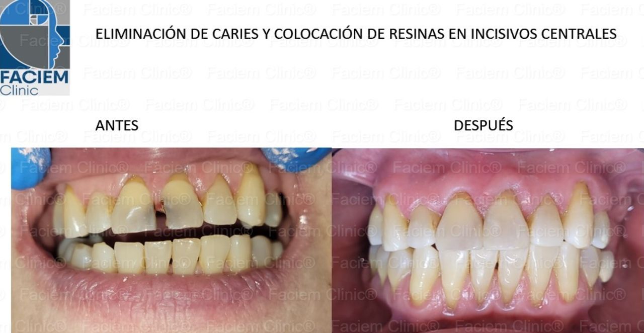 Arlen Colín Ordaz-32