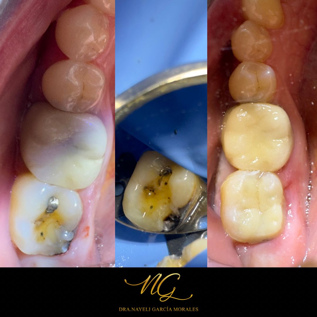 Nayeli Garcia Morales-11