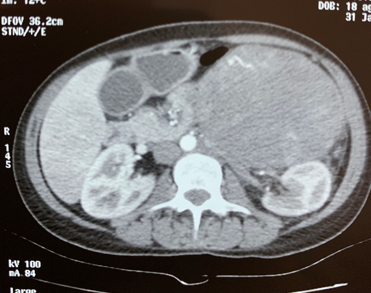 Pedro Matabuena Támez-7