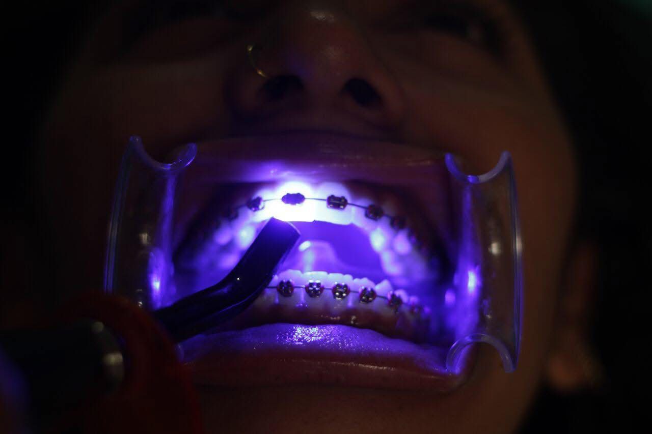 Xiuhnel Solorio Cuevas-11