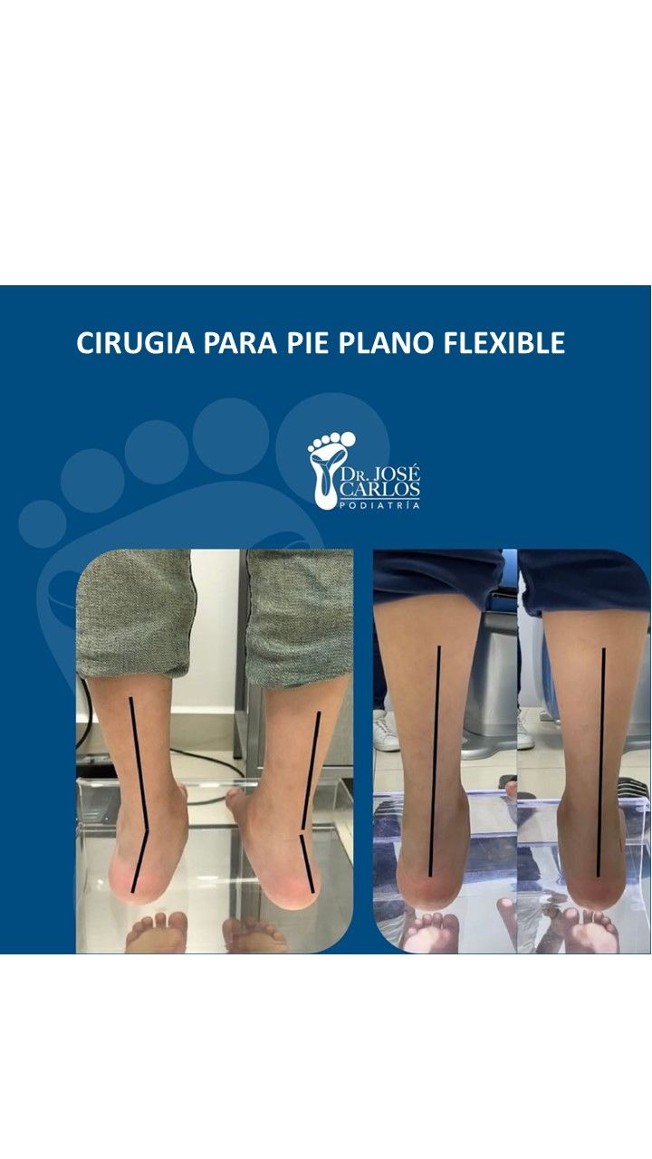 José Carlos Lopez Garza-21