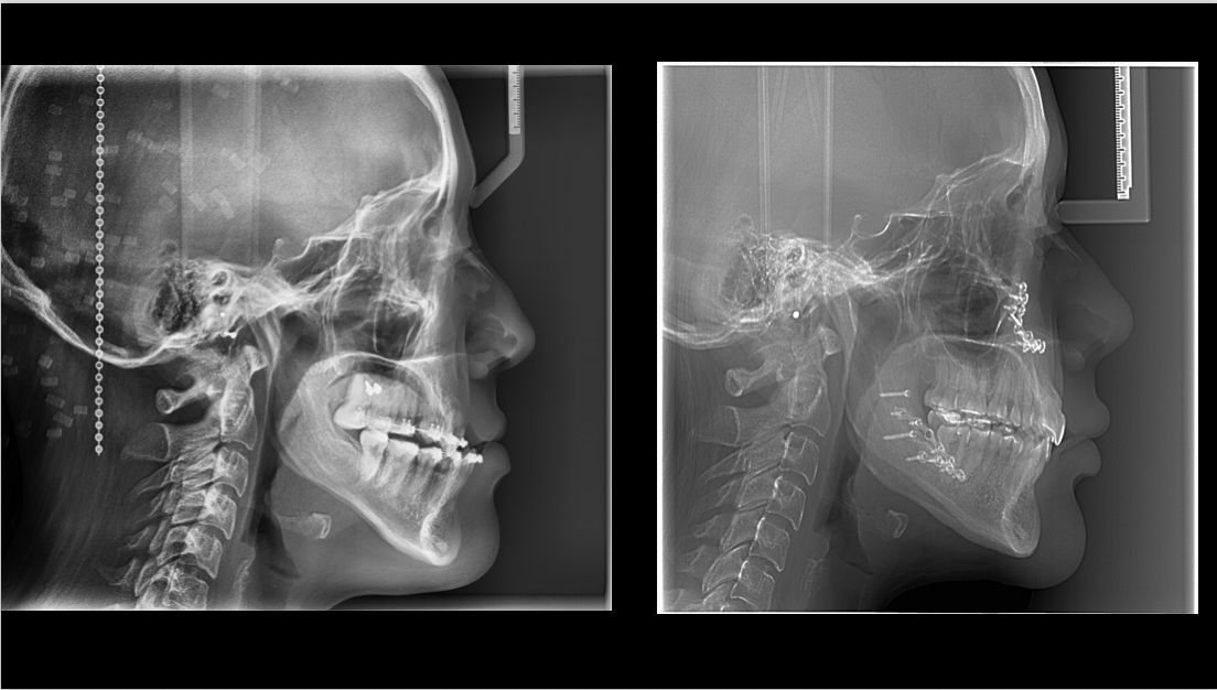 Emmanuel Guerrero Soto-9