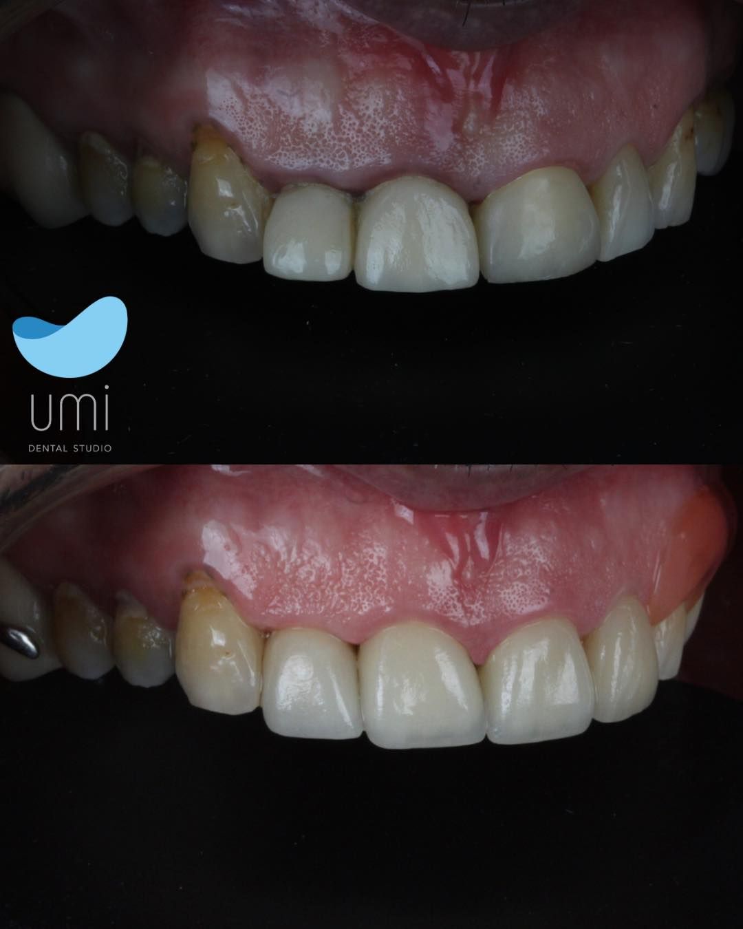 Anahí Bahena Sosa-4