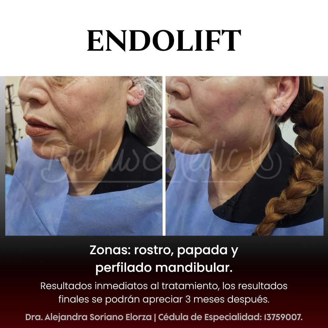 Alejandra Soriano Elorza-65