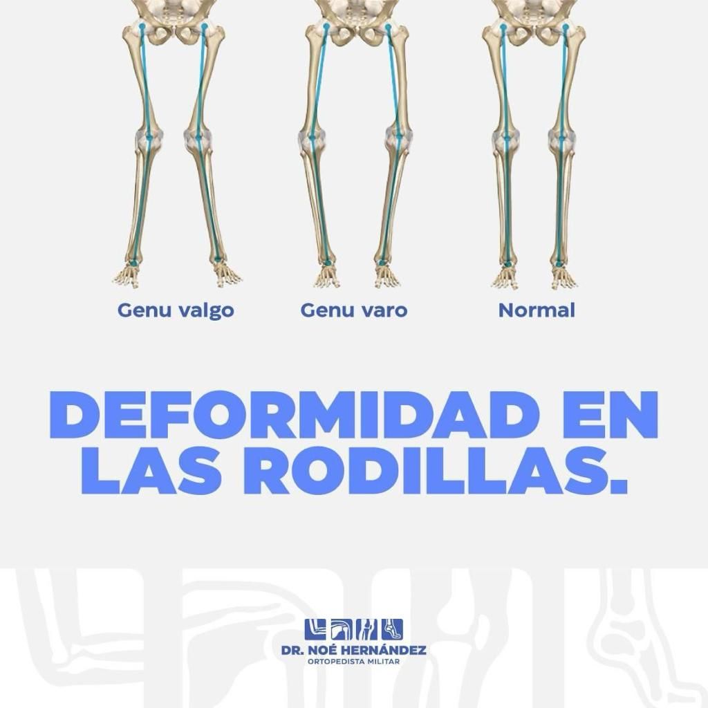 Noé Hernández Gómez-5