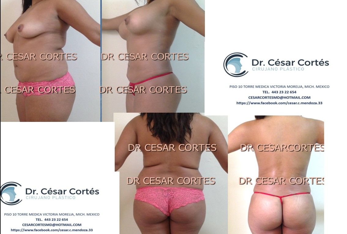 Cesar Cortes-13