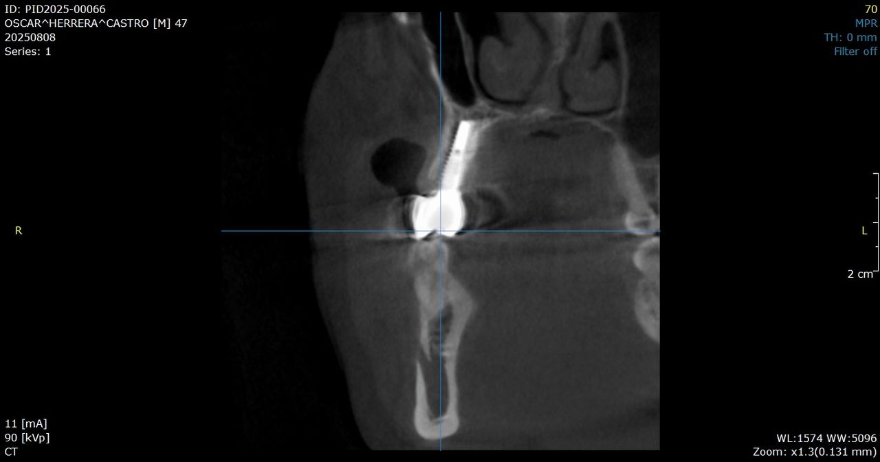 Marco Tulio Alzaga Vega-7