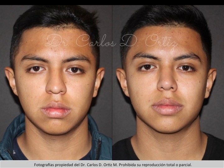 Carlos David Ortiz Moreno-33