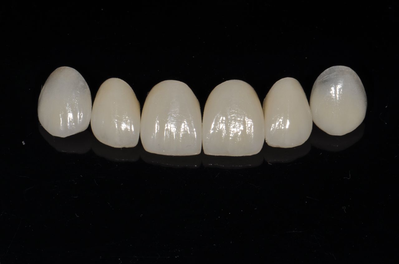 Ricardo Ayón García-3