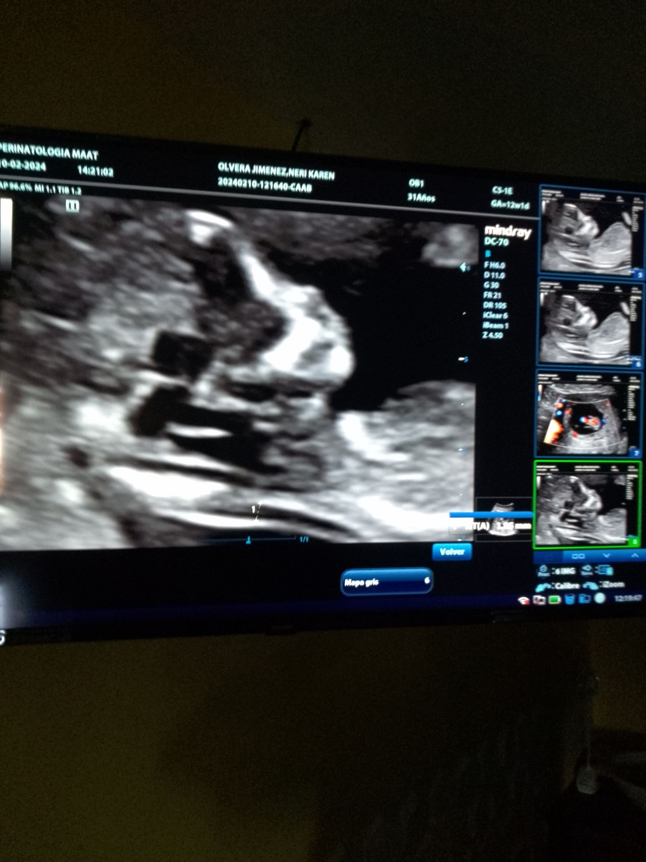 Carlos Gabriel Briones Vega-7