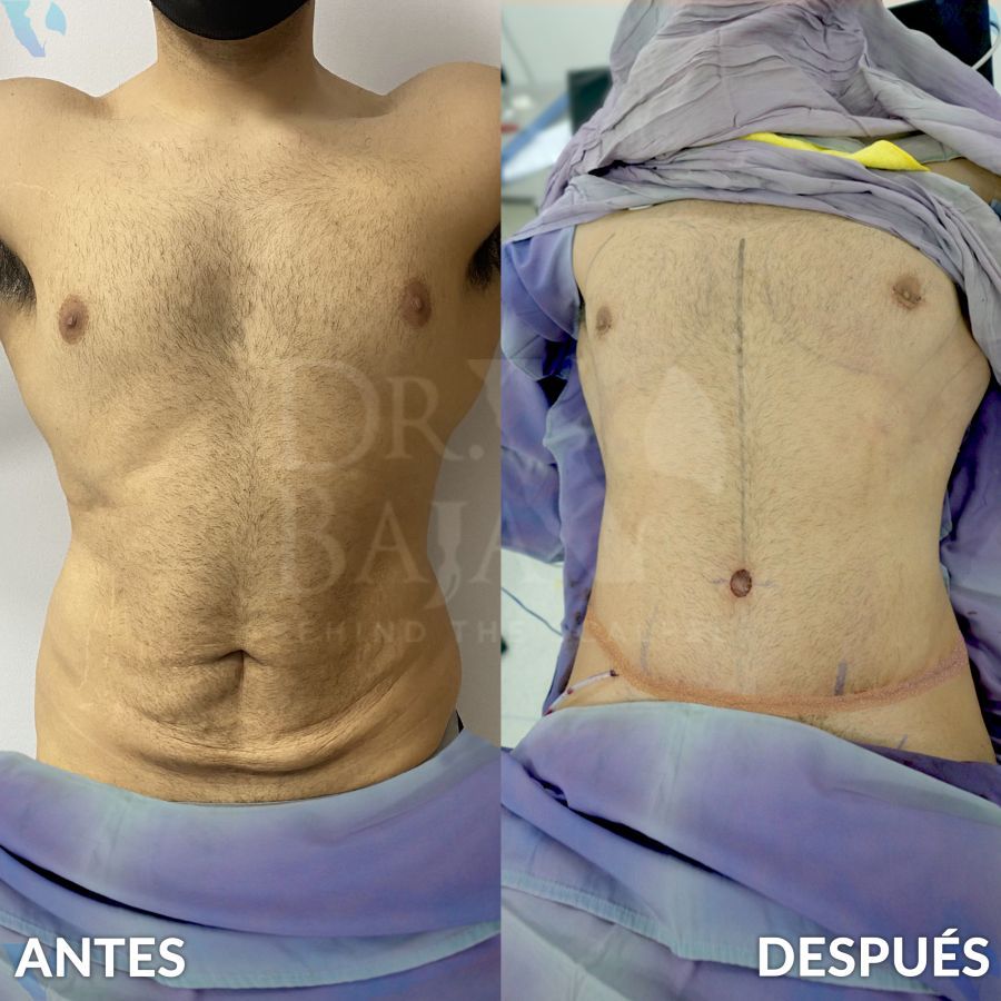 Renato Rodríguez Hirales-44