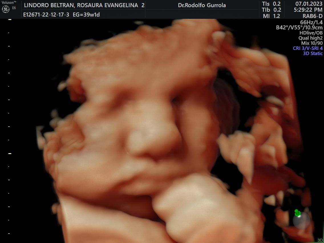 Rodolfo Antonio Gurrola Ochoa-9