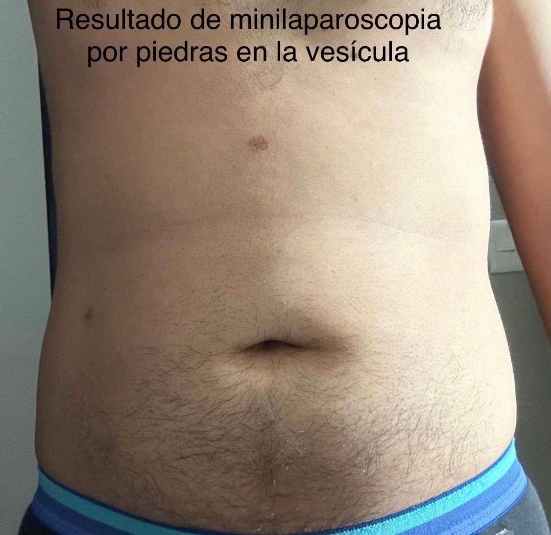 Hugo Alberto Rodríguez Verduzco-3