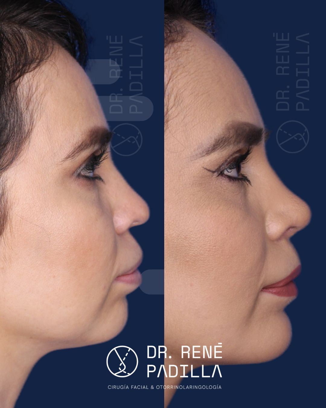 René E. Padilla López-29