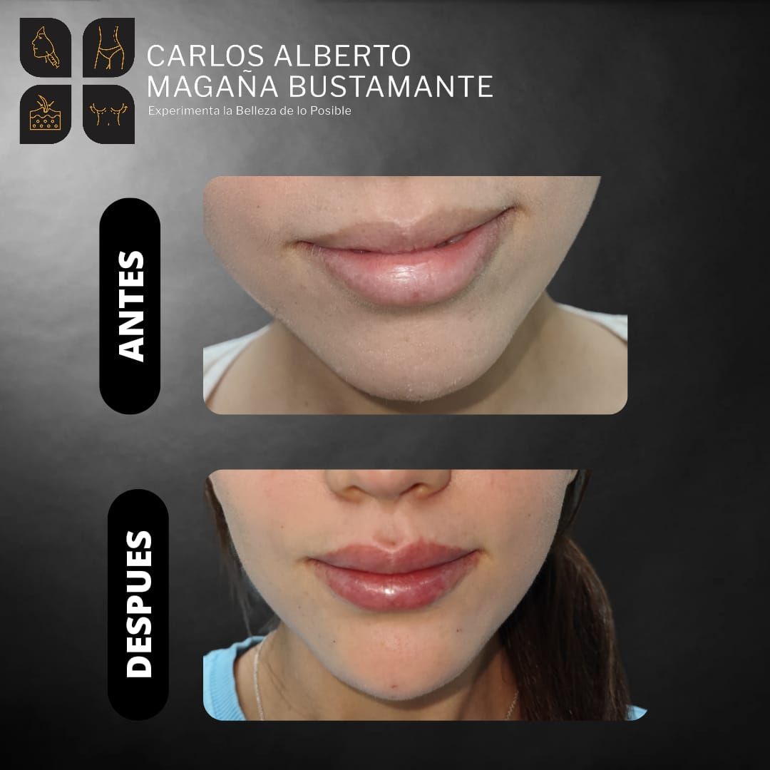 Carlos Alberto Magaña Bustamante-13