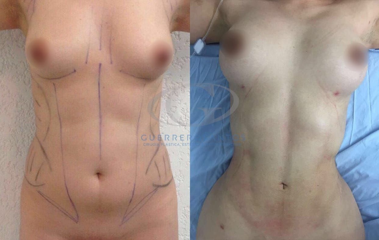 Fernando Guerrerosantos-14