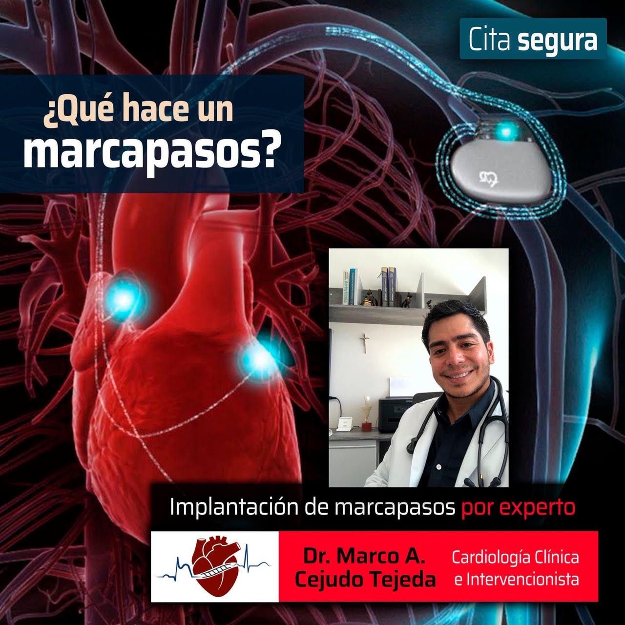 Marco Antonio Cejudo Tejeda-13