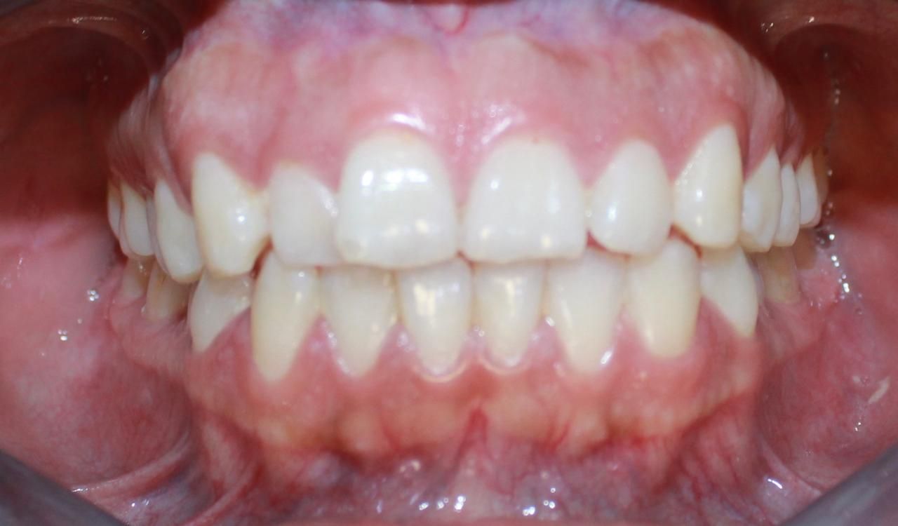 Jonathan Ortiz Zorraquin-12